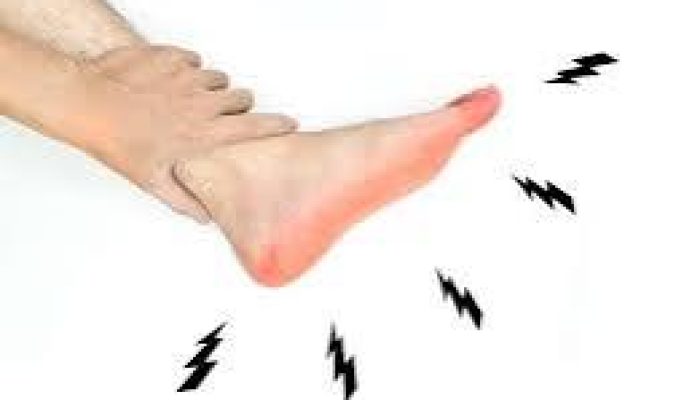 Masyararat Diimbau Tak Sepelekan Kesemutan, Bisa Jadi Gejala Stroke